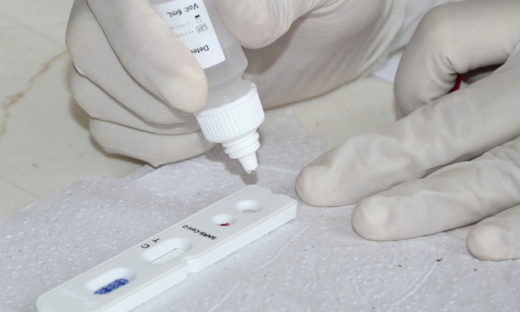 16 mil testes rápidos já foram disponibilizados pela Secretaria de Estado da Saúde (SES) para os 139 municípios