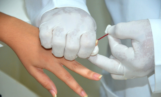 Diagnóstico precoce proporciona uma qualidade de vida melhor para as pessoas com HIV