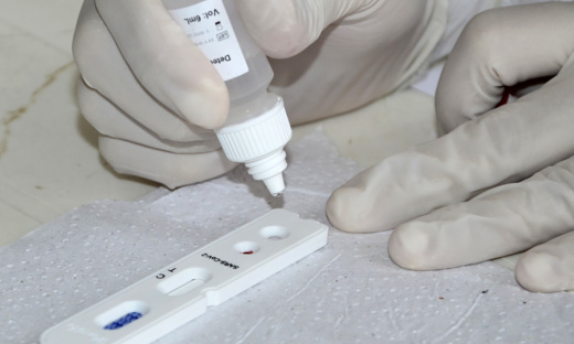 Saúde supre demanda de Teste Rápido agilizando diagnósticos da Covid-19